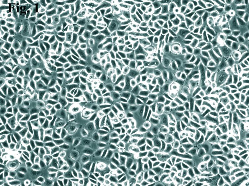 人角膜上皮细胞