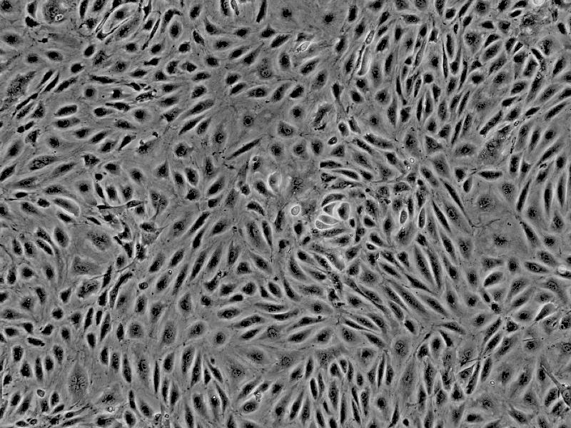 人子宫内膜微血管内皮细胞