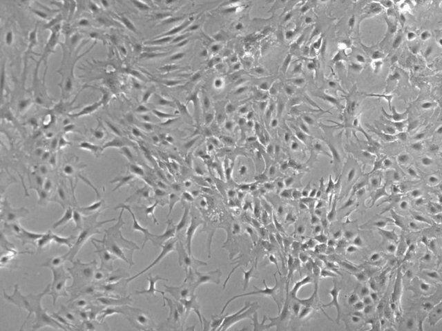 小鼠海马趾星形胶质细胞