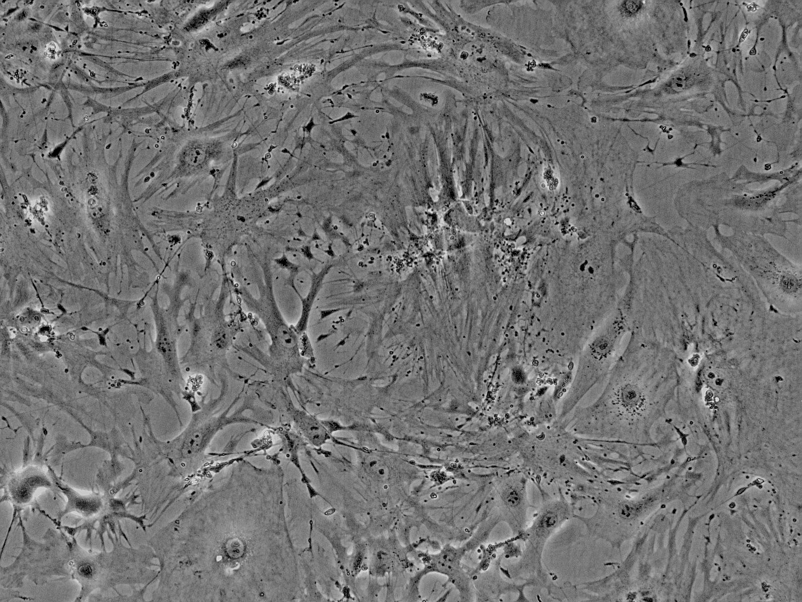 小鼠心脏成纤维细胞