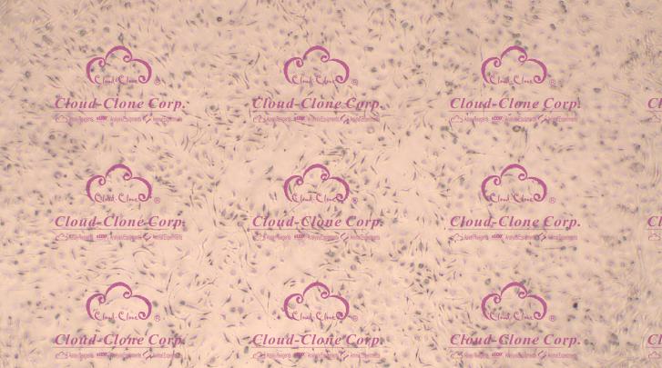 小鼠骨髓间充质干细胞(BMMSCs)