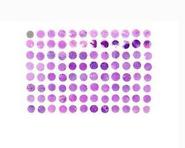 皮肤肿瘤组织芯片（SKT1501）