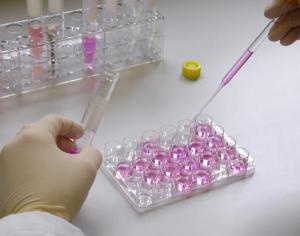 人大内皮素(Big ET)酶联免疫检测试剂盒