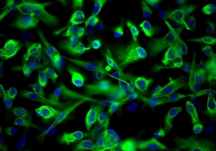 T24 人膀胱移行细胞癌细胞