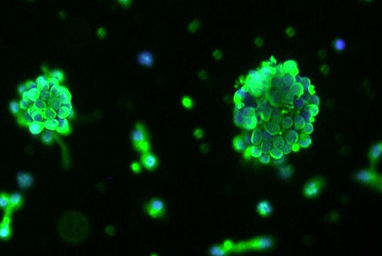 T/G HA-VSMC；人脐静脉血管内皮细胞