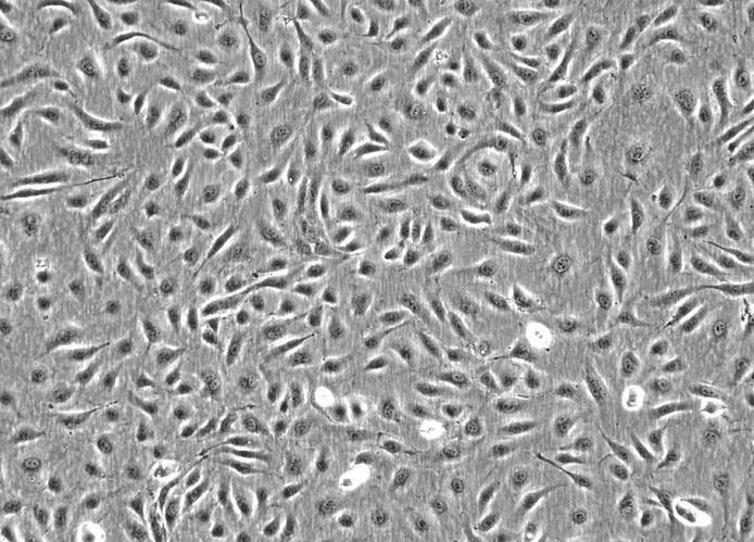 Kit225 IL-2依赖的人淋巴T细胞系