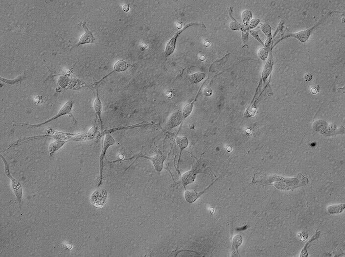 HSF人皮肤成纤维细胞株