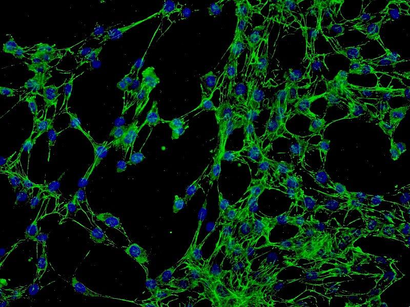 CRT人神经胶质瘤细胞