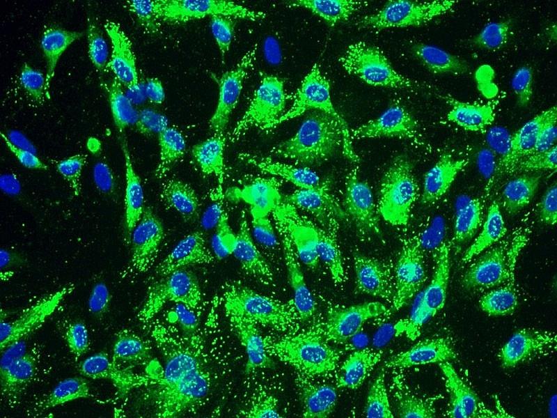 ECV-304人脐静脉内皮细胞