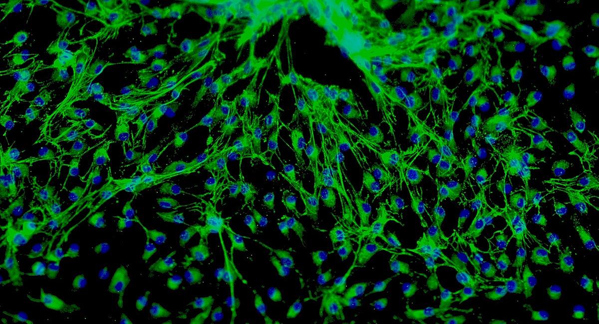 RIN-m5f大鼠胰岛β细胞瘤细胞