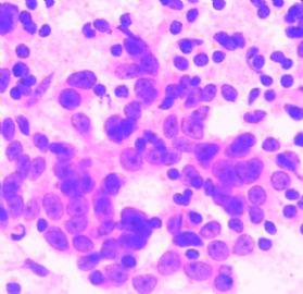 P388小鼠淋巴样瘤细胞实验