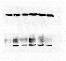 Western blot 免疫印迹（WB）