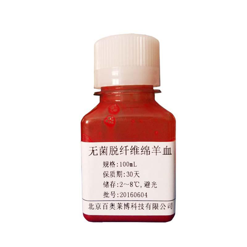 羊抗人IgA(α链特异)(抗血清)批发