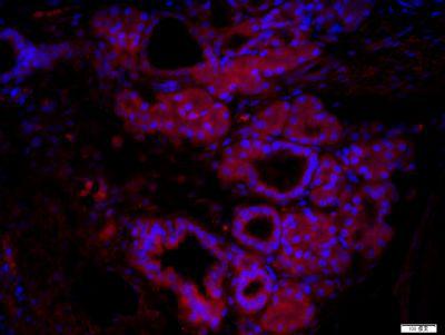 免疫组化，免疫荧光，免疫细胞化学（IHC/ICC/IF）检测服务