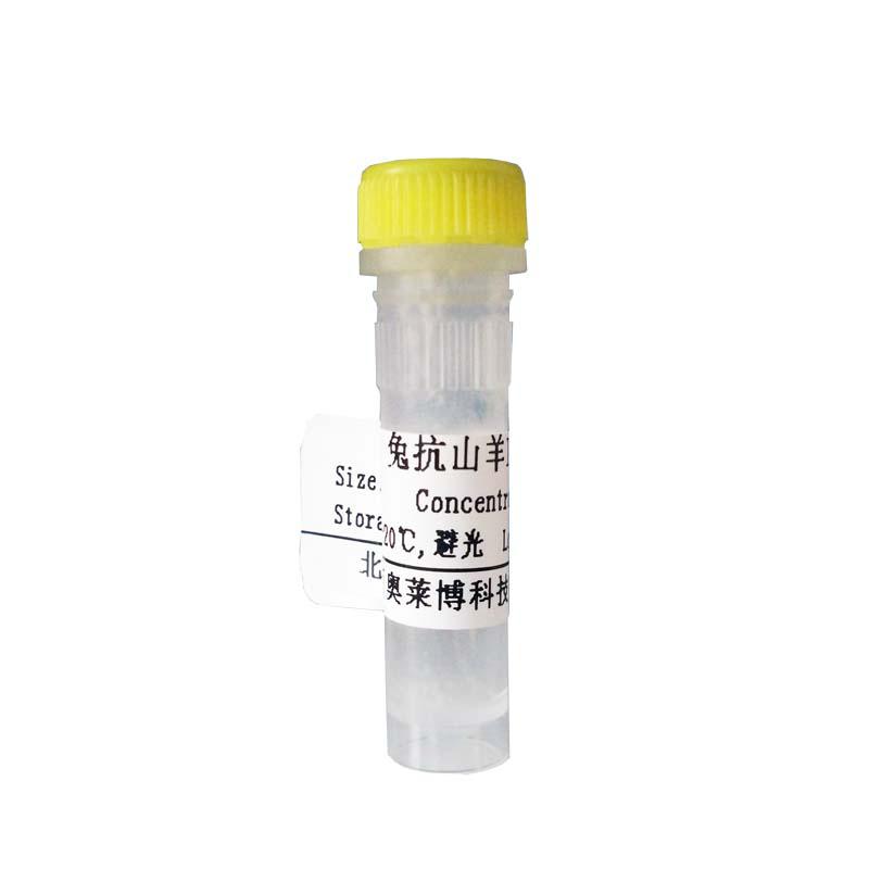 北京载脂蛋白B抗体厂家