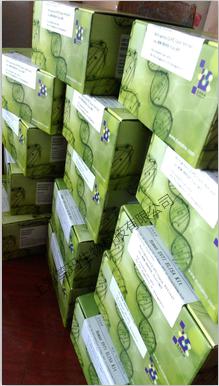 人基质金属蛋白酶10(MMP-10)ELISA试剂盒