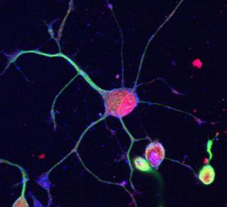 神经干细胞/Nestin/Ascl1/mash1/启动子