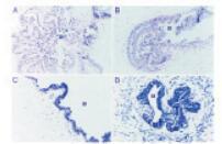 预混型BCIP/NBT溶液