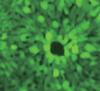 AAV在肝脏中的应用