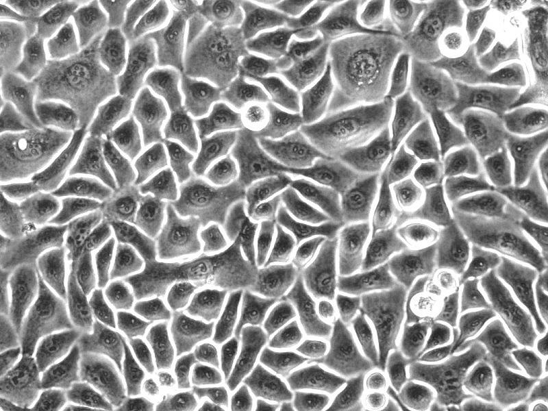 RT4人膀胱移行癌细胞
