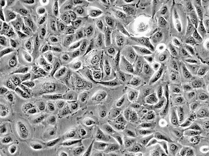 MuM-2C人侵袭性脉络膜黑色素瘤细胞