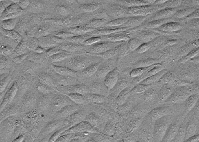 KLE人子宫内膜腺癌细胞