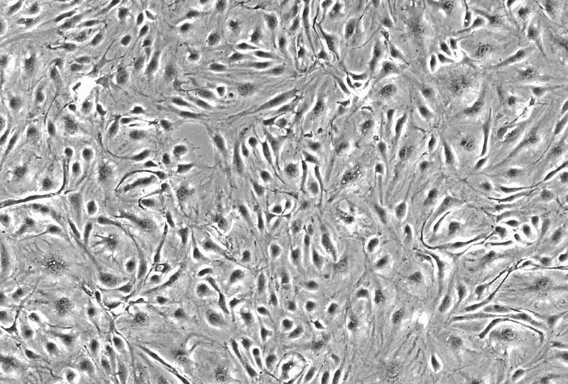 Ishikawa人子宫内膜癌细胞