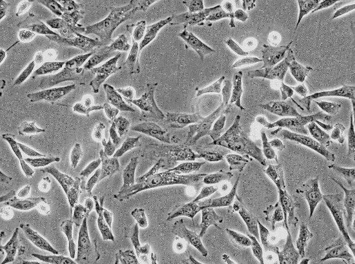 Hut 102人T淋巴瘤细胞