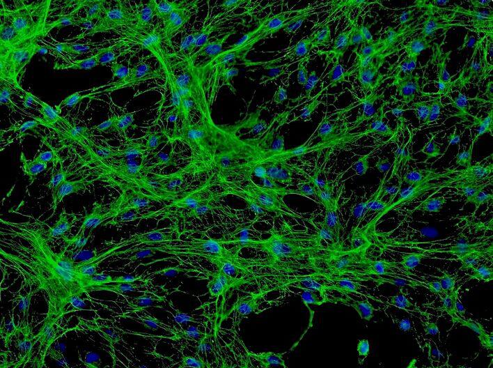 HFF人包皮成纤维细胞