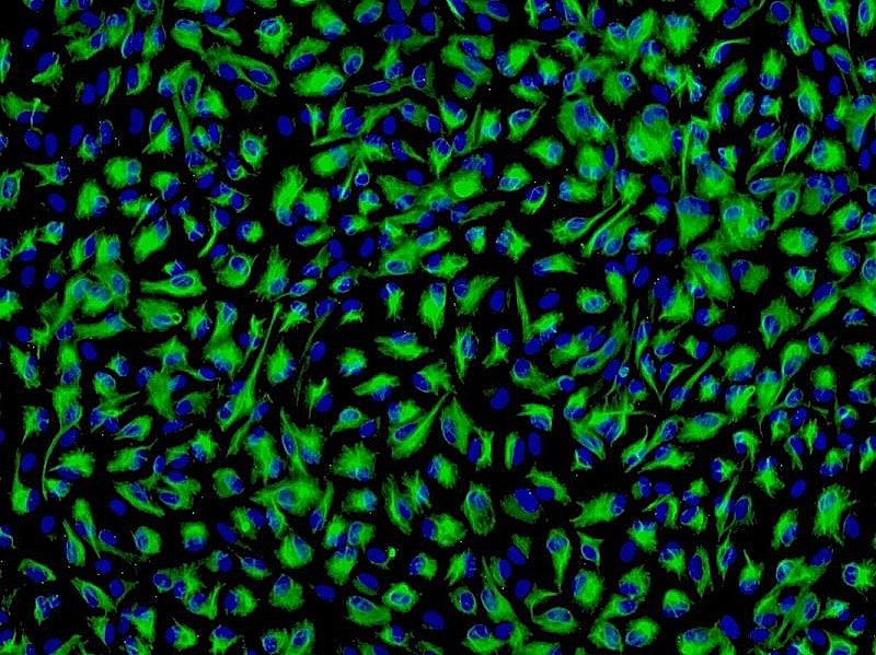 Hacat人永生化表皮细胞