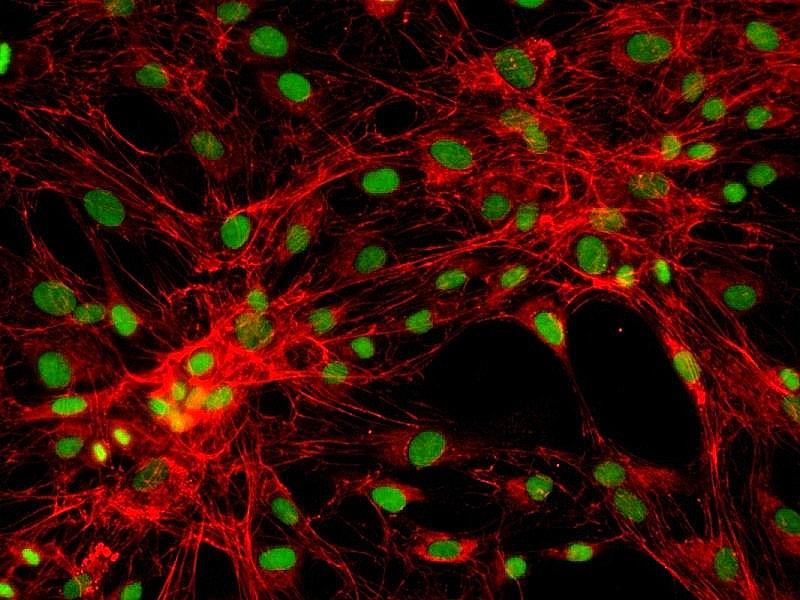 AML-193人急性单核细胞白血病单核细胞