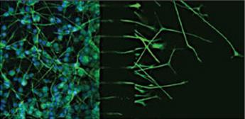 C918人眼脉络黑色素瘤细胞