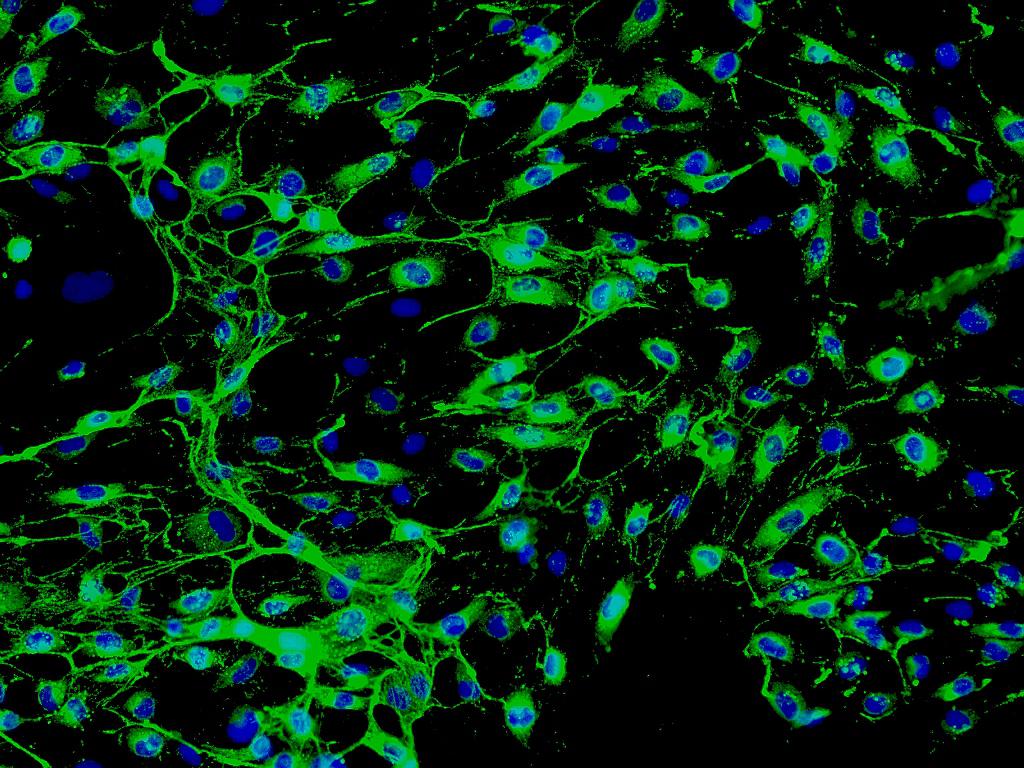 Min6；小鼠胰岛β细胞株