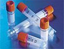 磷酸化胰岛素受体底物-1抗体