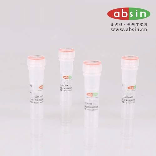 Rabbit anti-HLA-DQB2 Polyclonal Antibody,HLA-DQB2抗体