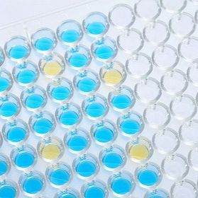 人唾液淀粉酶α1(AMY1)ELISA试剂盒 Human AMY1 (Amylase Alpha 1, Salivary) ELISA Kit