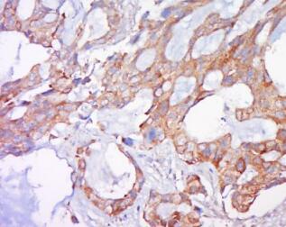 胱抑素C|半胱氨酸蛋白酶抑制剂C免疫荧光抗体