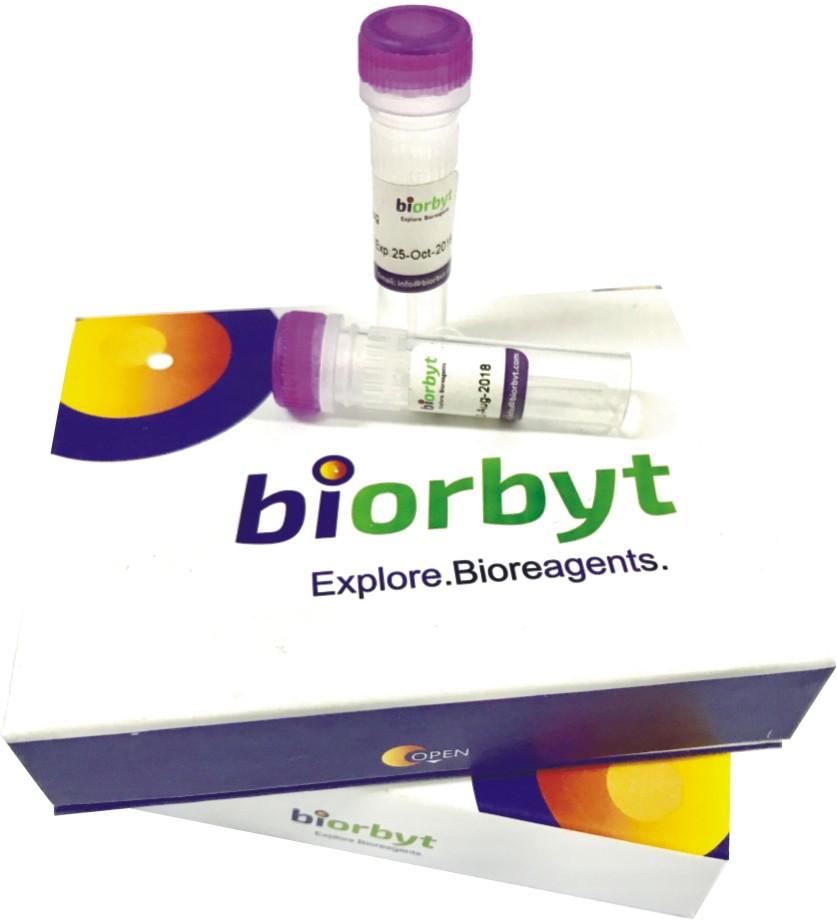 Human Galectin 2 protein