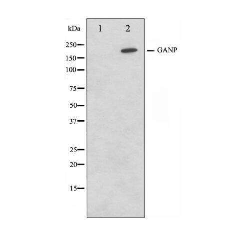 DF7427	CCL5 Antibody