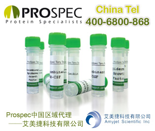 【S100b GST】重组人S100钙结合蛋白B,GST标签 | Recombinant Human S100 Calcium Binding Protein B,  GST Tag