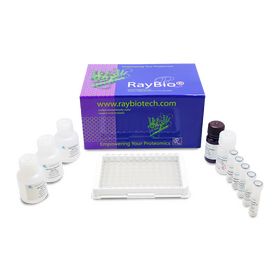 Custom Human Endocan ELISA
