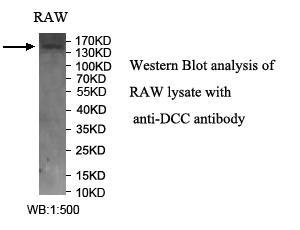 DCC抗体