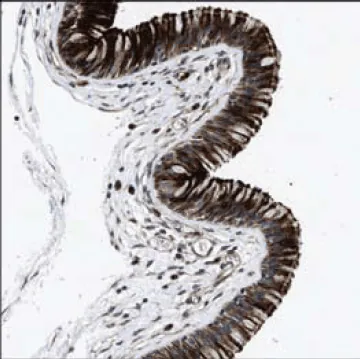 人鼻咽部的免疫组织化学染色使用Prestige Antibodies<sup>®</sup> Anti-DEFA5(货号HPA015775)显示呼吸道上皮细胞的细胞质和膜阳性。 人鼻咽部的免疫组织化学染色使用Prestige Antibodies® Anti-DEFA5(货号HPA015775)显示呼吸道上皮细胞的细胞质和膜阳性。