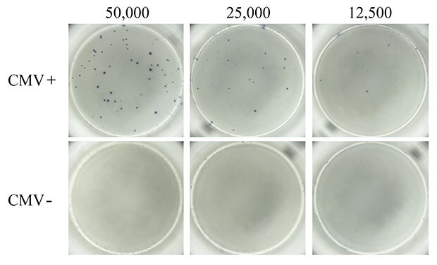 ELISpot assay using CMV-derived peptides to stimulate IFN-γ secretion. PBMCs from CMV-seropositive (top panel) and CMV-seronegative (bottom panel) donors were tested for the presence of CMV antigen-specific T cells capable of secreting IFN-γ upon CMV peptide stimulation. Samples from donors with a history of CMV infection (CMV+) produced numerous and well-defined spots corresponding to IFN-γ-secreting T cells when stimulated with the CMV peptide pool. Samples from donors who lacked previous infection (CMV-) failed to produce any detectable spots in response to the CMV peptide pool. Varying levels of cells were seeded into each well of a MultiScreen<sup>®</sup> HTS-IP filter plate as indicated. ELISpot assay using CMV-derived peptides to stimulate IFN-γ secretion.