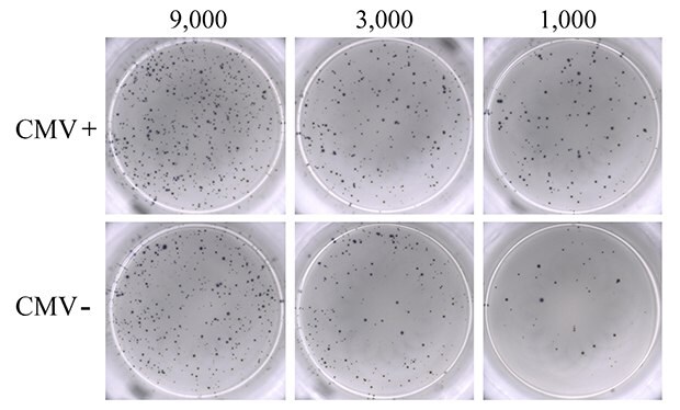 ELISpot assay using 0.3 µM ionomycin + 0.2 µM PMA to stimulate IFN-γ secretion from PBMCs. Results from CMV-seropositive (CMV+; upper panel) and CMV-seronegative (CMV-; lower panel) donors are shown. PBMCs were seeded into the MultiScreen<sup>®</sup> HTS-IP filter plate at three different densities as indicated (9,000, 3,000, and 1,000 cells/well). Untreated PBMCs from seropositive donors (negative control) showed results ranging from 0 to 3 spots (data not shown). ELISpot assay using 0.3 µM ionomycin + 0.2 µM PMA to stimulate IFN-γ secretion from PBMCs.