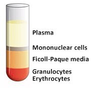 移除上层前。 移除上层前。